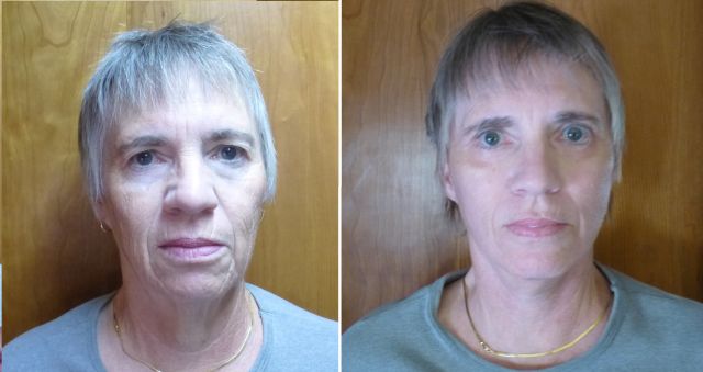Gayle before and after Gayle before and after