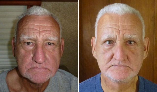 Jim before and after Jim before and after
