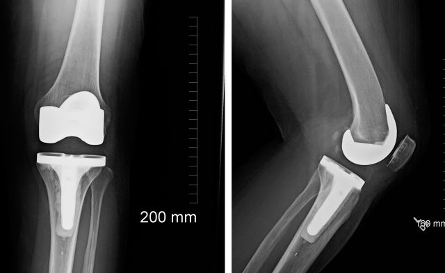 Left knee Left knee