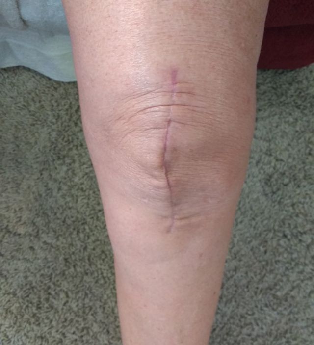 Left knee Left knee