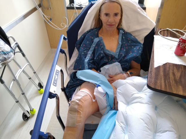 Knee replacement Knee replacement