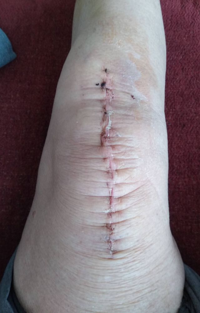 Knee Knee