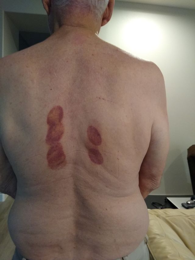 Jim back Jim back